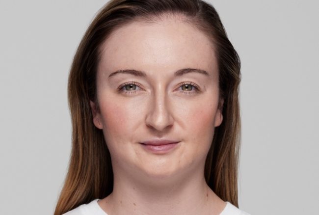 Restylane Eyelight Before and After - Case 2, Image 2 - Female, age 35 – 44 - Texas - Lockhart Matter Dermatology & Aesthetic Center